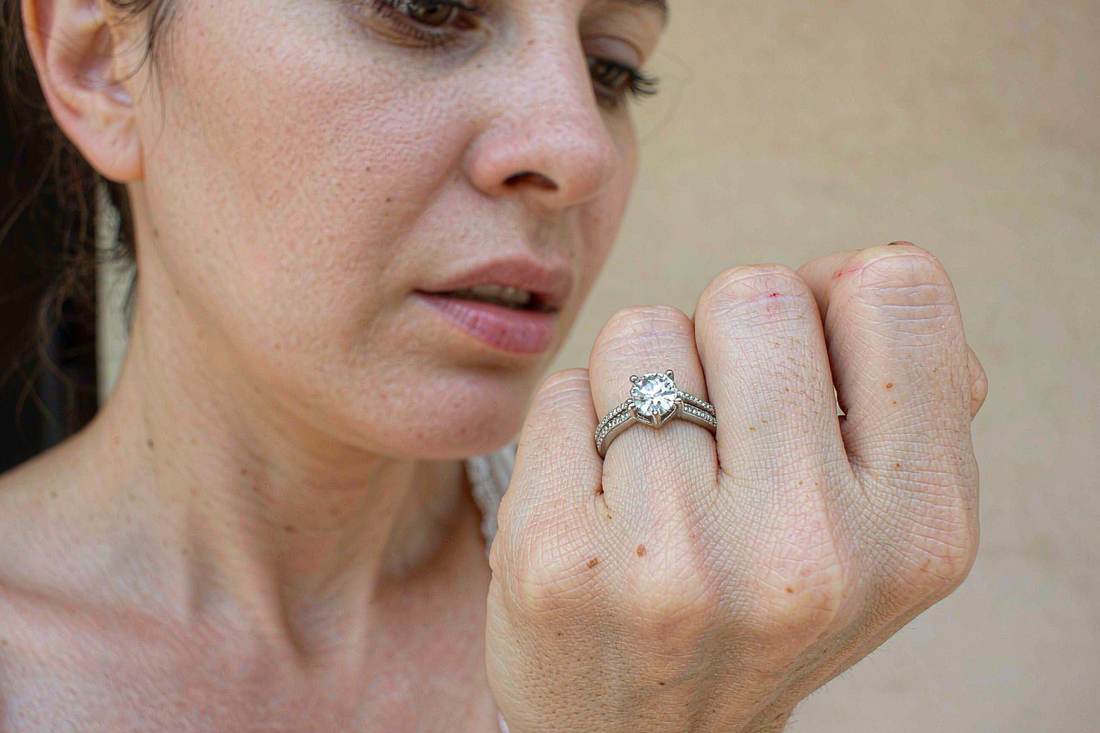 woman's hand with engagement ring stuck on slightly swollen finger in soft daylight