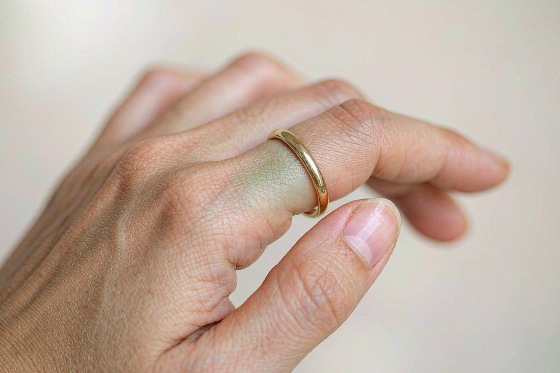 close up of woman removing gold ring revealing faint green mark on finger